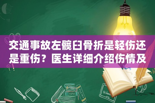 交通事故左髖臼骨折是輕傷還是重傷？醫生詳細介紹傷情及處理方法